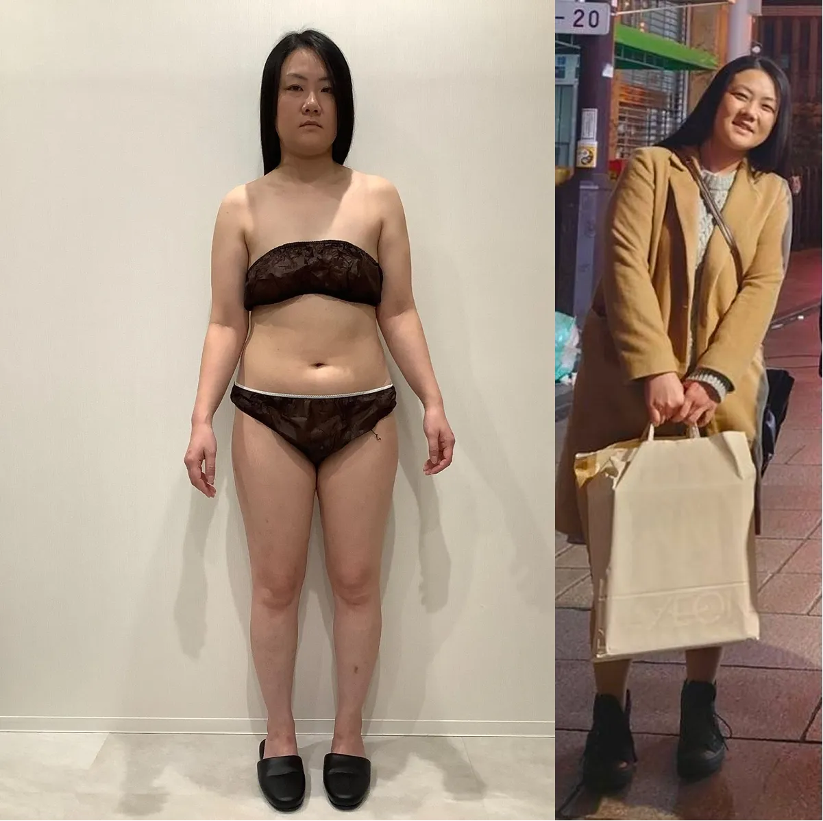 医療ダイエットを始める前
