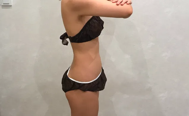 【20代 女性】
