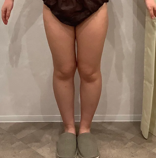 【20代 女性】
