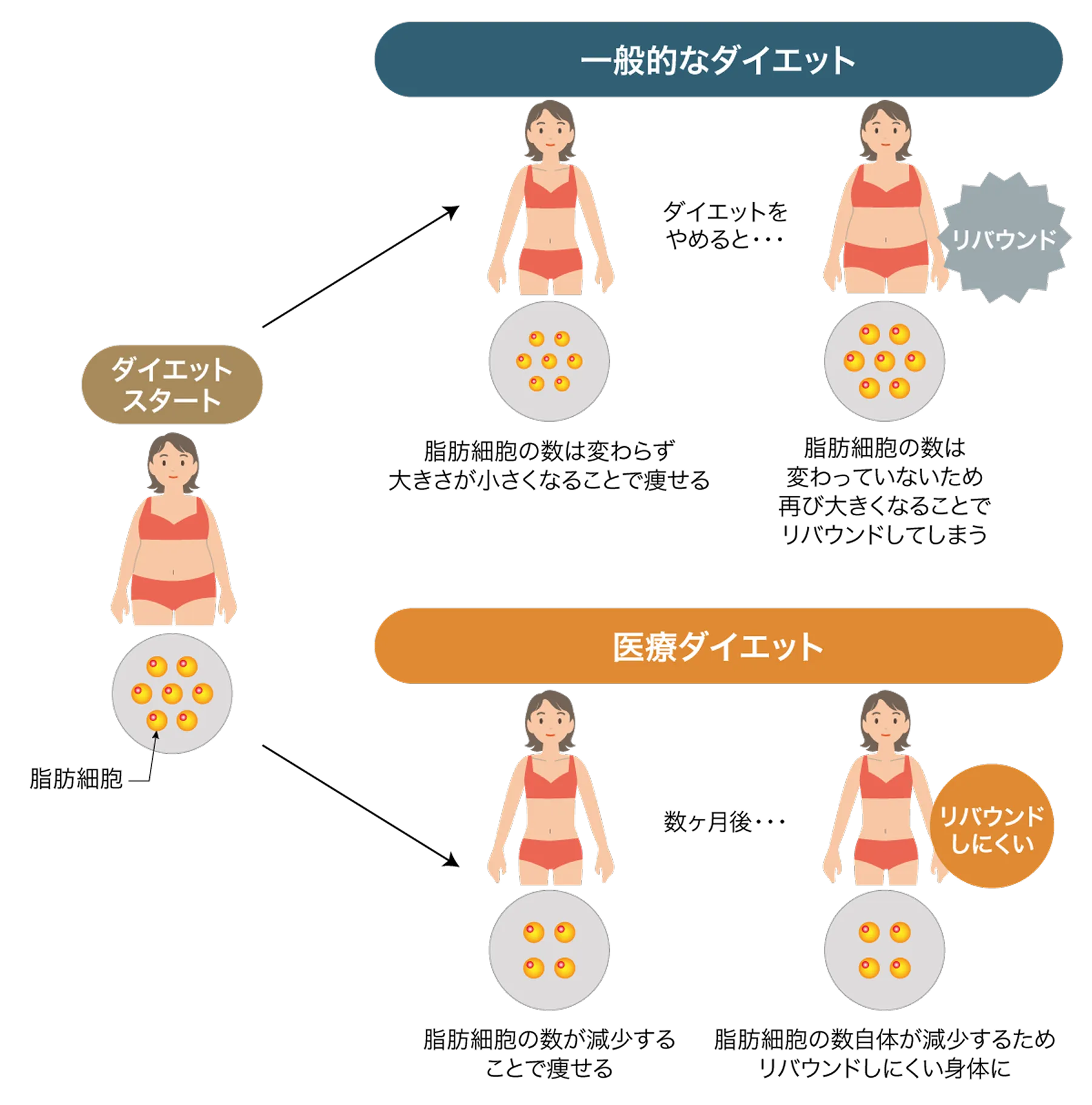 お腹痩せを実現する4つの治療メソッド