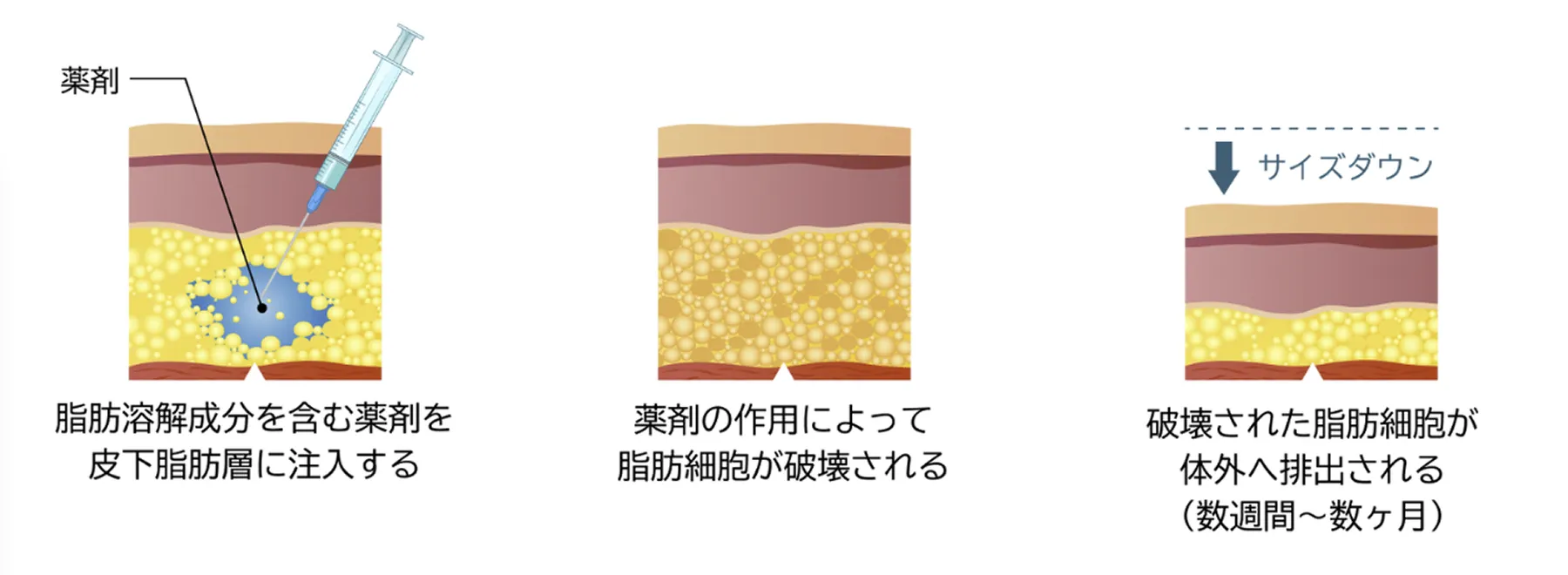 カベリン