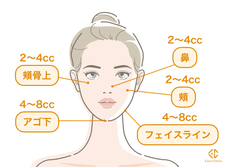 顔の脂肪溶解注射の注入目安