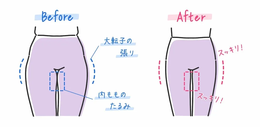 太もも痩せのイラスト