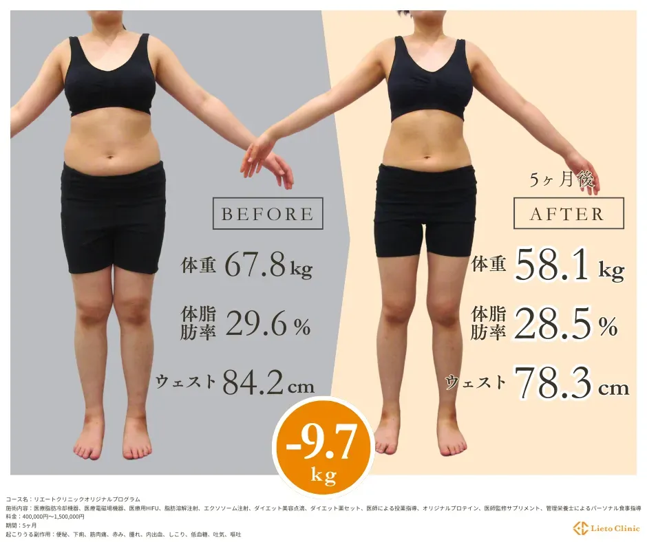 症例：20代女性 / -9.9kg / 身長164cm