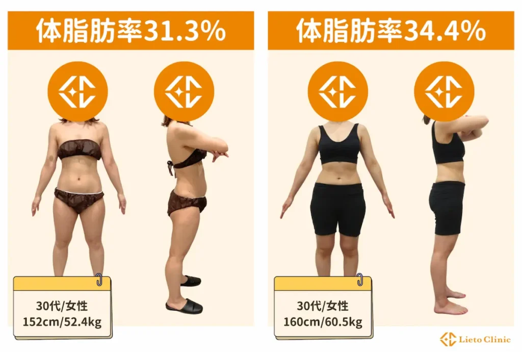 体脂肪率30～35％の女性