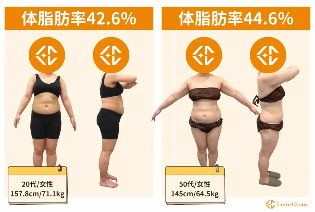 体脂肪率40％以上の女性