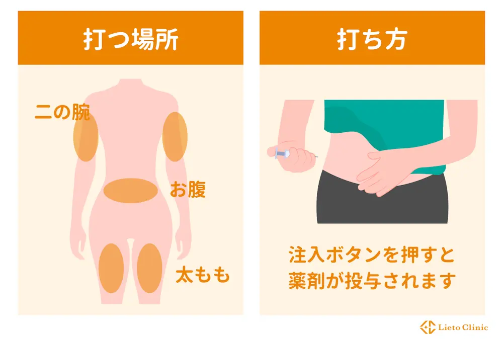 サクセンダの使い方