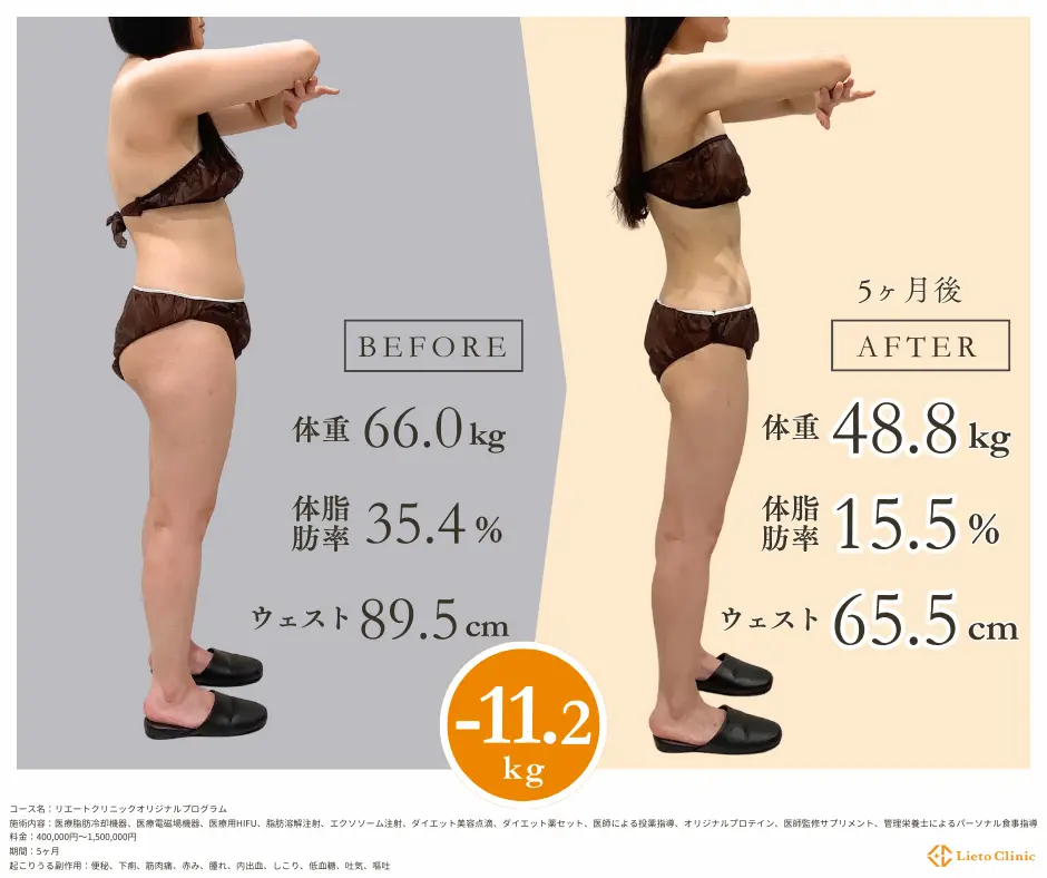 30代女性 / -9.1kg / 161cm