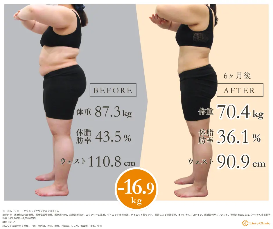 40代女性 / -16.9kg / 155.6cm