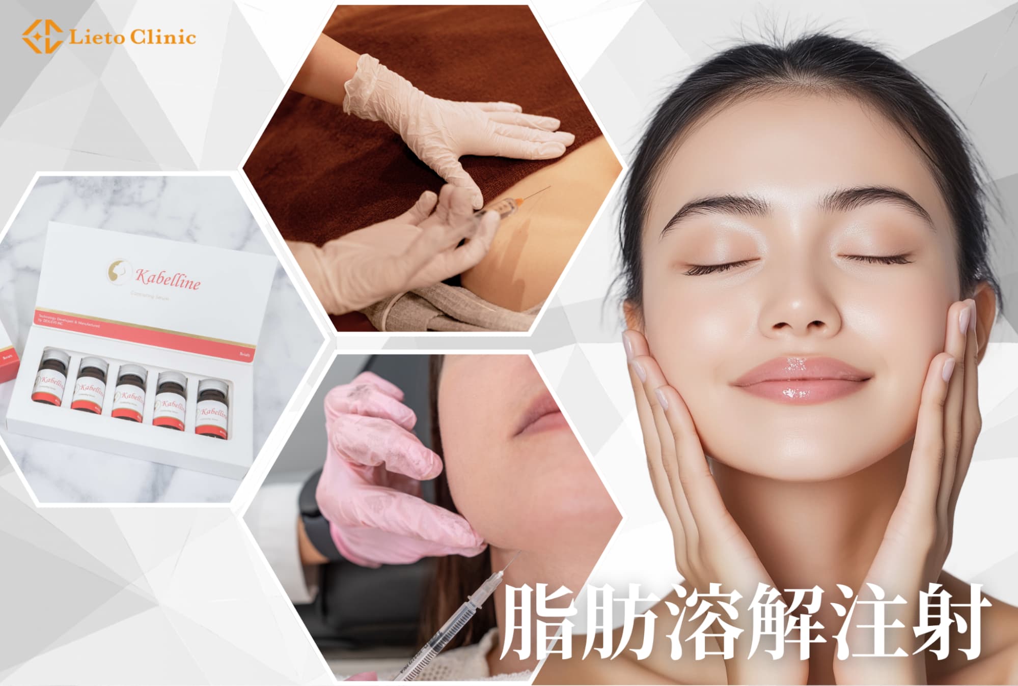 脂肪溶解注射