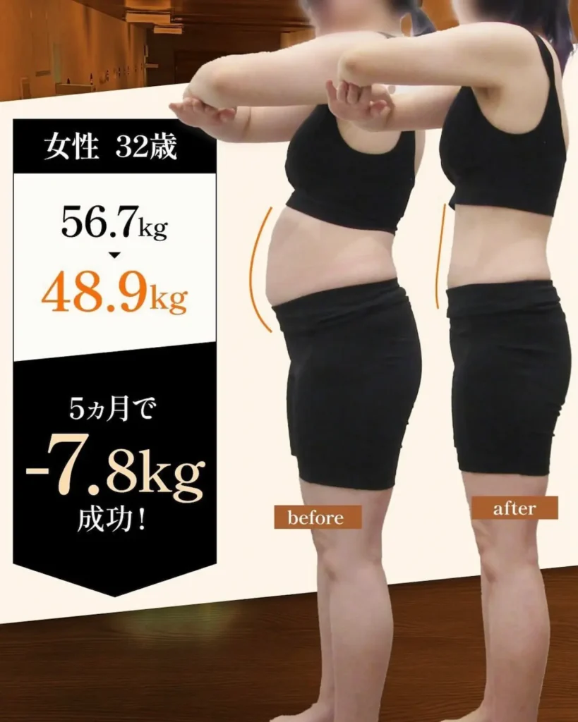 30代女性の医療ダイエットのビフォーアフター(5ヶ月後)