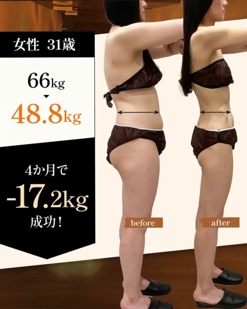 30代女性の医療ダイエットのビフォーアフター(4ヶ月後)