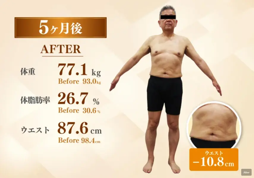50代男性 医療ダイエット4ヶ月後(-15.9kg)