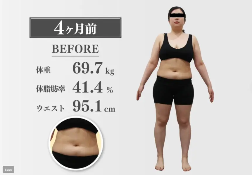30代女性 医療ダイエット開始前