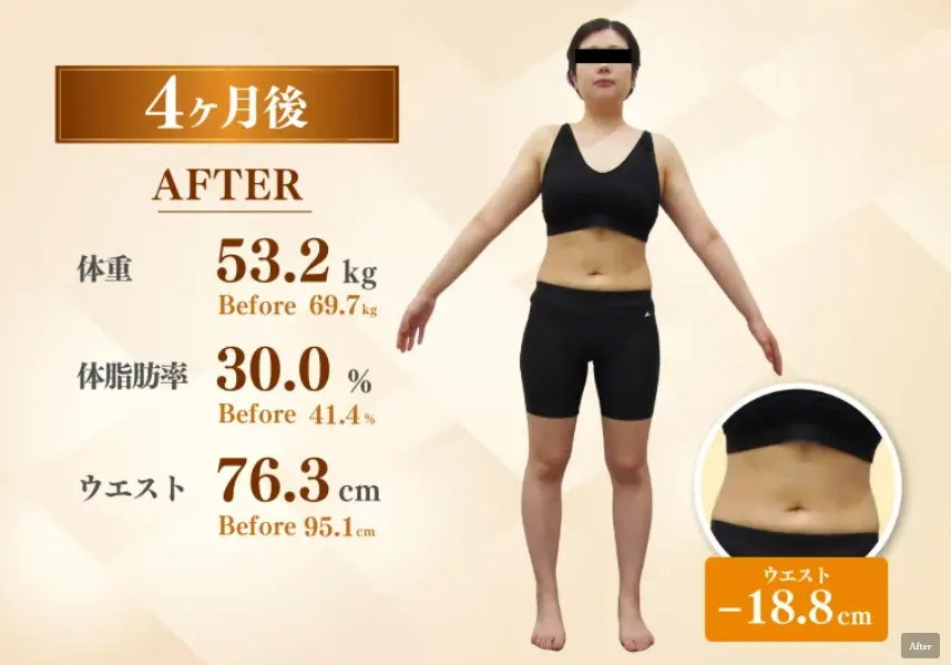 30代女性 医療ダイエット4ヶ月後(-16.5kg)