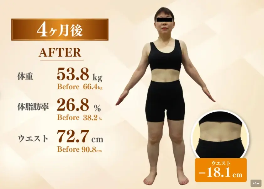 50代女性 医療ダイエット4ヶ月後(-12.6kg)