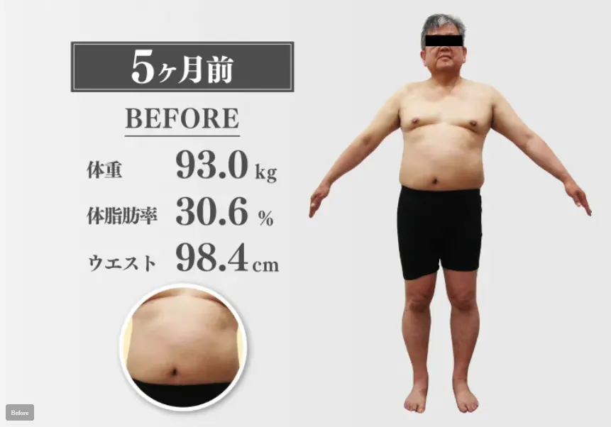 50代男性 医療ダイエット 開始前