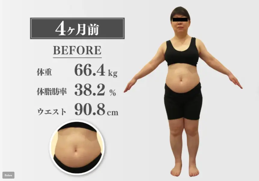 50代女性 医療ダイエット開始前
