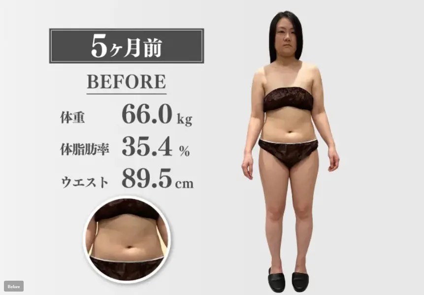 30代女性 医療ダイエット開始前