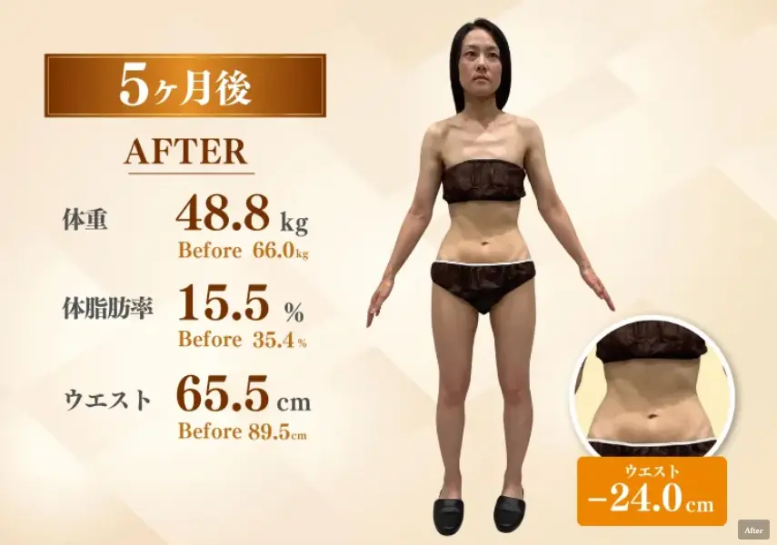 30代女性 医療ダイエット5ヶ月後